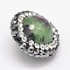 Natural Ruby in Zoisite Polymer Clay Rhinestone Flat Round Beads FIND-F003-10-2